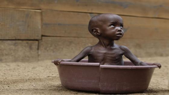 طفل عمره سنتين الاستحمام في كينيا، في 11 يوليوز 2011.
((Rebecca )Blackwell/AP/SIPA(Rebecca )
(Blackwell/AP/SIPA
نشرت في 21-07-2011 في 09:11 بواسطة سيريل بون