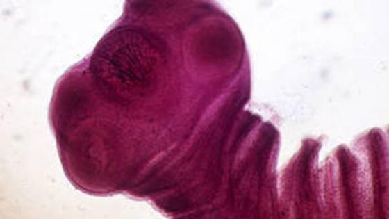 أول عشرة طفيليات تنتقل عبر الغذاء